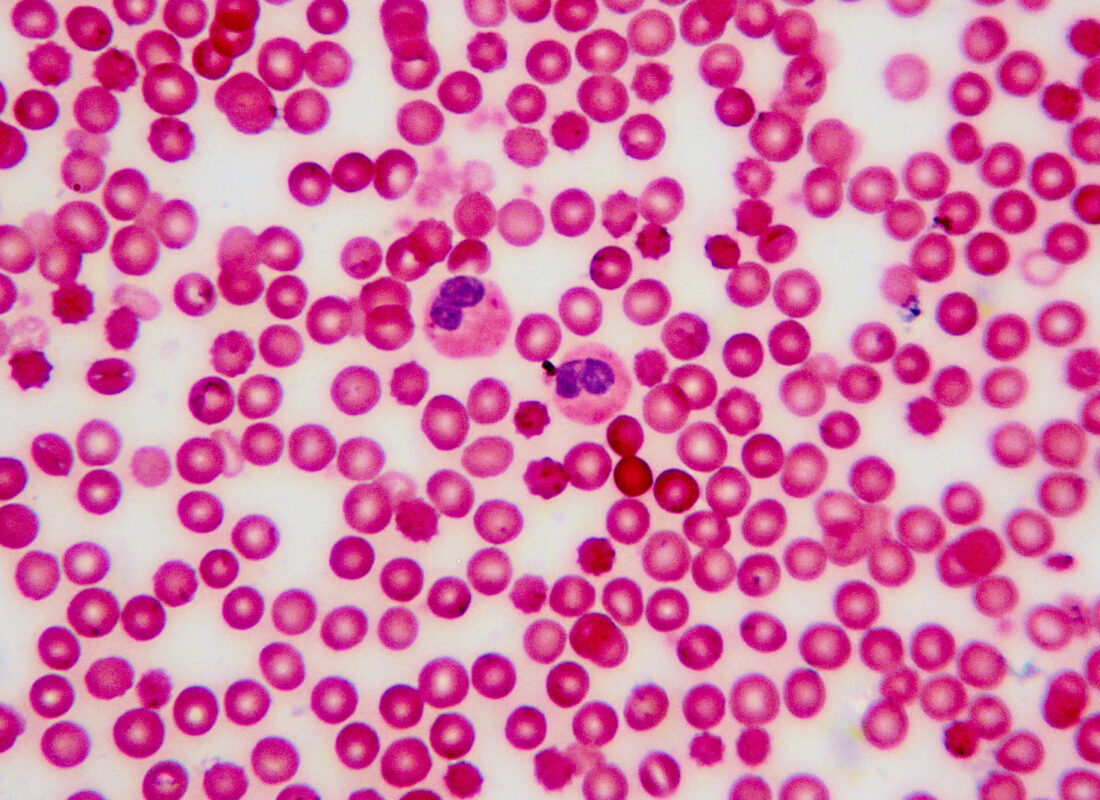 Mikroskopie: rote und weisse Blutzellen